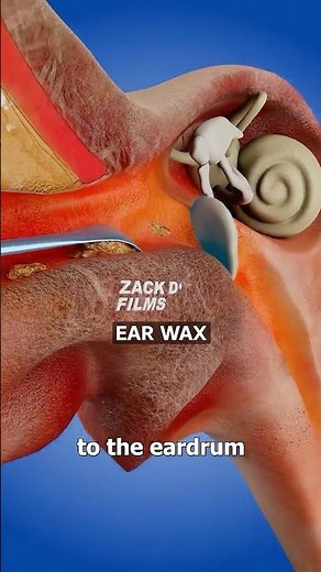 How Ear Spoons Work 🤔 Surgeon Reacts