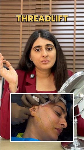 Thread Lift in Delhi | Threadlift before and after | Would you try a thread lift? | PDO Thread Lift
