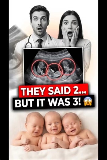 THE DOCTOR SAW 1! BUT IT WAS 3! 🤯#babyshorts #ultrasound #triplets #asia