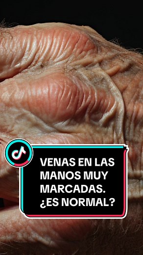 ¿Por qué se ven las venas marcadas en las manos?