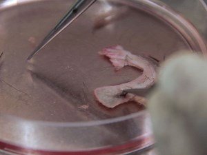 Isolation and Culture of Neural Crest Stem Cells from Human Hair Follicles