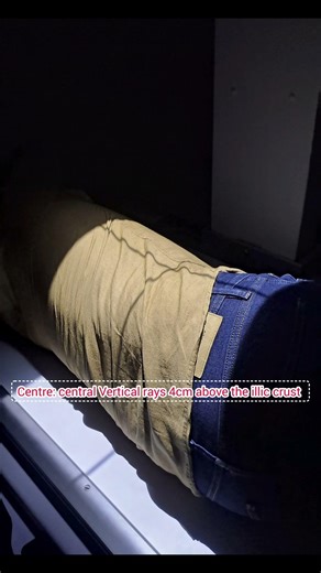 lumbar Spine lateral view