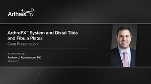 ArthroFX™ System and Distal Tibia and Fibula Plates