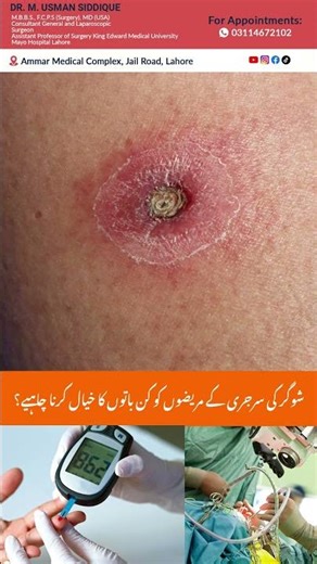 Essential Pre-Surgery Tips for Diabetic Patients