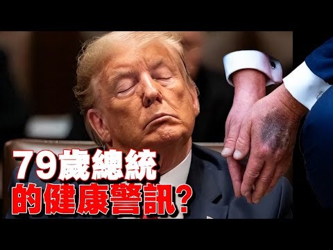 79歲總統的健康警訊？手背瘀青與阿斯匹靈爭議引爆白宮危機！ #川普健康 #美國寒流 #美伊關係 #美國總統 #極端天氣 #中東局勢 #美軍部署 #美國政治 #國際關係 #氣候變遷