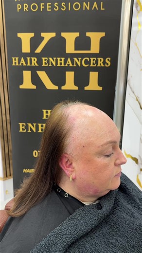 Our new Meshless integration system! #hair #meshlessintegration #hairtok #hairloss