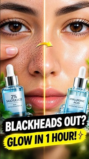 BLACKHEADS OUT → GLASS-SKIN GLOW IN 1 HOUR? 😳 #Blackheads #Skincare