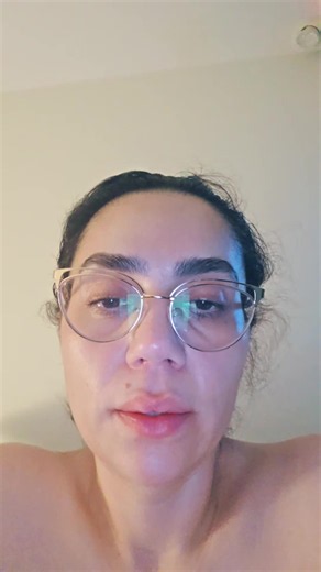 Day 15 post-op mommy makeover, lipo360, Fleur-de-Lys, bottom and chest lift, reduction, skin removal, ab and hernia repair. #skinremovalsurgery #drillichnavarro #bellahouserecovery #mommymakeoverjourney #tijuanamexico