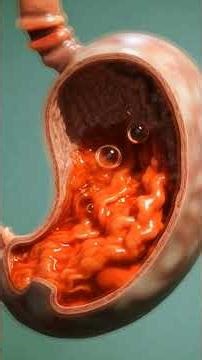 What Happens Inside Your Body When You Eat Raw Garlic? (3D Medical Animation)#RawGarlic