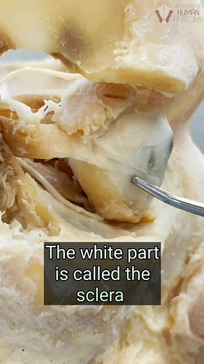 Real human eye! See the eye in a directed skull along with the muscles that control its movement #optometry #stem #anatomy #optometrist #science #disection