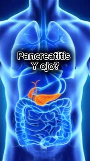 Retinopatía en pancreatitis aguda