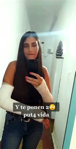 LONG ARM CAST AND SHORT ARM CAST