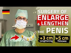 Penis Enlargement Surgery !! (lengthening +3 cm, thickening +5 cm)