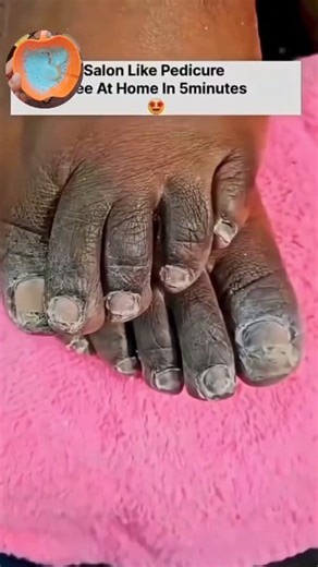 1.1M views · 4.2K reactions | Dark Feet Cleaning Tips | Easy Pedicure At Home ✅ Get Fair Feet Instantly . . . #pedicure #dirtremoval #tanningremoval #feetcleaningtips #fairfeet #reelsfbシ #reelsviralシ #fbreelsfypシ゚ #reelsvideo #fbreels #reelschallenge #explorepage | Natural Beauty Remedy | Facebook