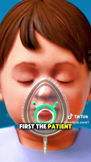 How Myringotomy Procedure is Done? (3D Animation) #how #ring #eardrum #drain #3danimation