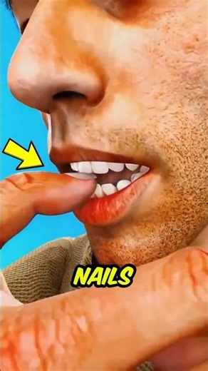 What Happens If You Keep Biting Your Nails😱