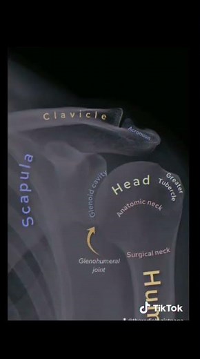 How to Read a Shoulder X-ray – Fast & Easy!" #radiology #anatomy