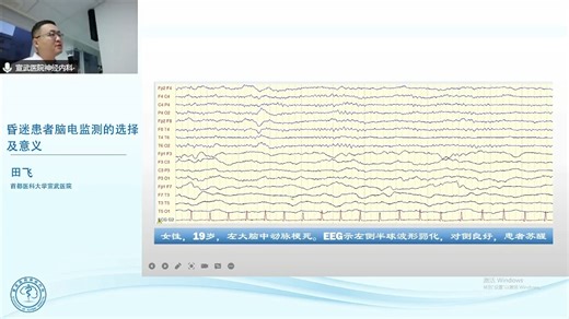 昏迷患者脑电监测的选择和意义 田飞