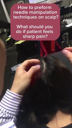 How to preform needle manipulation techniques on scalp? What should you do if patient feels sharp pain while scalp acupuncture ? The workshop of New Balance Method Acupuncture will host in the following countries 1. Sydney, Australia 🇦🇺 https://jo.my/sydney 2. Warsaw, Poland 🇵🇱 https://jo.my/poland Pulse Balance Acupuncture workshop will be in London in April 2024. #Sydney-Australia2024Jan #poland2024April #london2024April #whatsapp-id-6421449348 #email-contact-INFO@AcuTcmSchool.Com | Acupun