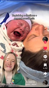 Let’s talk general anesthesia with a c section, why it happens, and what happens to your baby if that’s the case. OG video from @ciaralynnsmith on TT #birth #pregnant #laboranddelivery #nurse #csection #generalanesthesia #birtheducation #momlife #momtobe #hospital | Kara The Baby Nurse