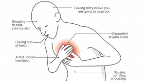 Know When It’s A Cardiac Arrest   8 Symptoms And Tips To Recovery