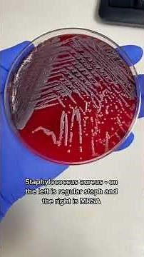 Appearance of some bacterias on culture media & under microscope 🔬