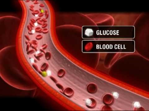 What is Type 1 Diabetes?