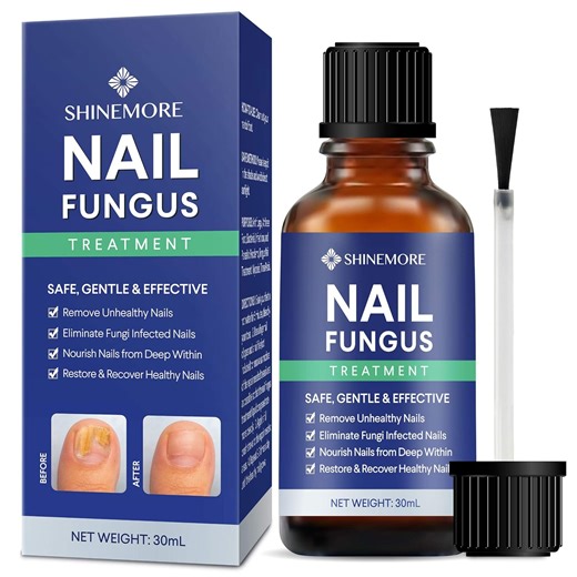 what does it mean when toenail fungus turns black
