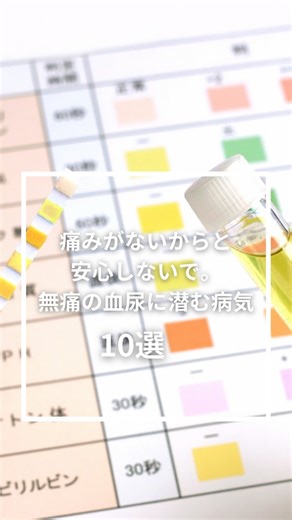 あおいつきの健康雑学ラボ🌱 on Instagram: "⭕️膀胱がん： 血尿の最も代表的な原因の一つ。50代以上に多く、「痛くない血尿」が特徴です。 ⭕️腎臓がん： 初期は無症状で、血尿が出た時には進行している場合もあります。 ⭕️尿管がん： 腎臓と膀胱をつなぐ管にできるがんです。 ⭕️前立腺がん： 男性特有。進行すると血尿や排尿障害（尿が出にくい）が出ます。 ⭕️尿路結石： 腎臓や尿管に石ができる。「のたうち回るような激痛」とセットのことが多いです。 ⭕️膀胱炎： 女性に非常に多い。排尿時の痛みや、何度もトイレに行きたくなる症状があります。 ⭕️腎盂腎炎（じんうじんえん）： 腎臓まで細菌が入る感染症。高熱と背中の痛みが出ます。 ⭕️IgA腎症： 自分の免疫が腎臓を攻撃してしまう病気。放置すると将来的に人工透析が必要になることもあります。 ⭕️前立腺肥大症： 加齢で前立腺が大きくなり、尿道を圧迫。血管が切れて出血しやすくなります ⭕️腎梗塞（じんこうそく）： 腎臓の血管が詰まり、細胞が死んでしまう緊急事態。突然の腰痛や血尿が出ます。 #血尿 #泌尿器科#病気のサイン #放置厳禁 #