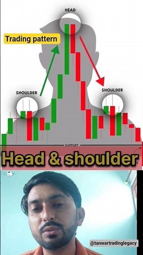 "Market ka Biggest Secret! 😱 Head & Shoulders Pattern Se Paise Kaise Banaye 📉💰"