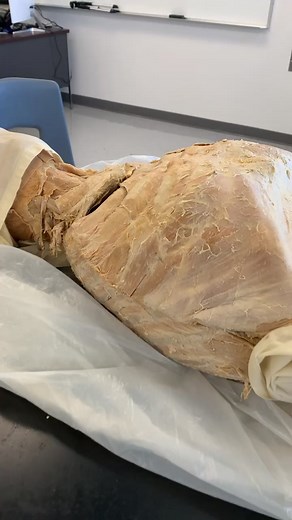 Understanding Tracheotomy: Exploring the Cricothyroid Membrane