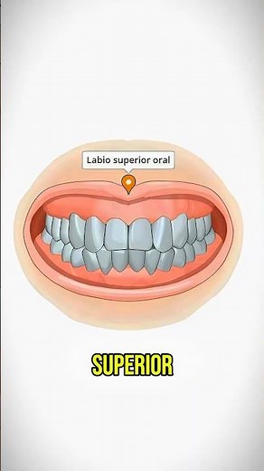 Fisura labial (Labio leporino) #medicina