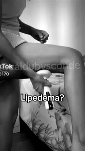 vacumterapia portátil 12 niveles de calor 12 niveles de succión y muchos mas funciones Estamos en Caracas #venezuela #vacuum #celulitis #viral #cuerpo