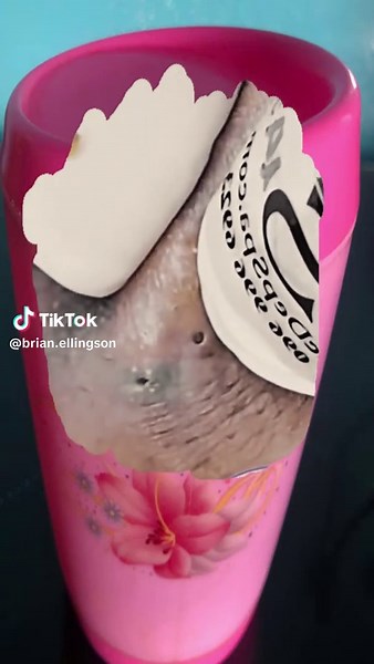 Effective Pimple and Blackhead Removal Techniques