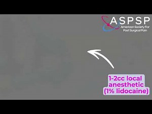 Pudendal Nerve Block