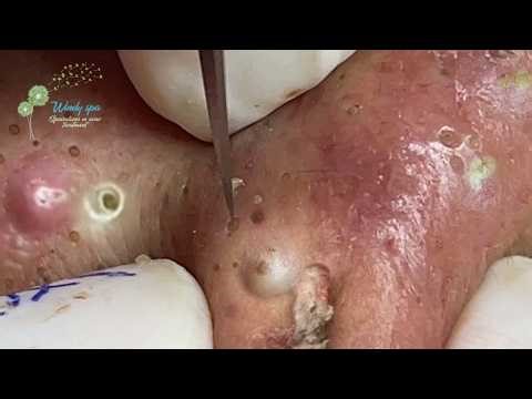 𝑺𝒐𝒐𝒕𝒉𝒊𝒏𝒈 𝑭𝒂𝒄𝒊𝒂𝒍 𝑻𝒓𝒆𝒂𝒕𝒎𝒆𝒏𝒕 𝒇𝒐𝒓 𝑺𝒕𝒓𝒆𝒔𝒔 𝑹𝒆𝒍𝒊𝒆𝒇 | 𝑫𝒆𝒆𝒑 𝑪𝒍𝒆𝒂𝒏𝒊𝒏𝒈 & 𝑪𝒂𝒍𝒎𝒊𝒏𝒈 𝑴𝒂𝒔𝒔𝒂𝒈𝒆 𝒂𝒕 𝑳𝒖𝒙𝒖𝒓𝒚 𝑺𝒑𝒂 #48114