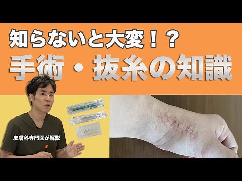 Things you need to know about surgery and stitch removal