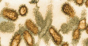 Why Was It Called the 'Spanish Flu?' | HISTORY