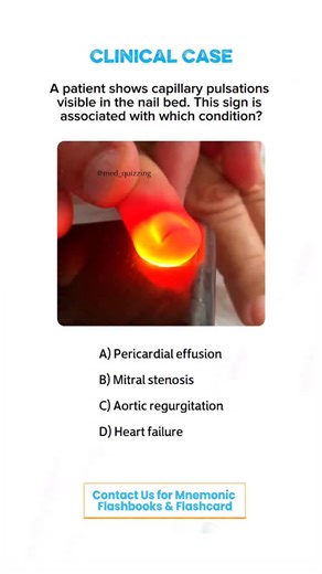 𝑴𝒆𝒅 𝑸𝒖𝒊𝒛𝒛𝒊𝒏𝒈 on Instagram: "Comment “Details” and check your inbox for the full mnemonic flashbook & flashcards! 📕✨ . . . . . . #medical #medicine #medicalstudent #medicinestudent #usmle #step1 #plab #mrcp #medicine #reels #viral #foryou #anatomy #reelexplore #instagram #neurology #nephrology #surgery #students #colleges #cardiology #knowledge #virals #plab #UK #USA #newyork #nyc #neet"