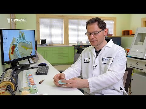 When a Dentist Should Choose Acrylic, Flexible or Metal Partial Dentures | Stomadentlab.com