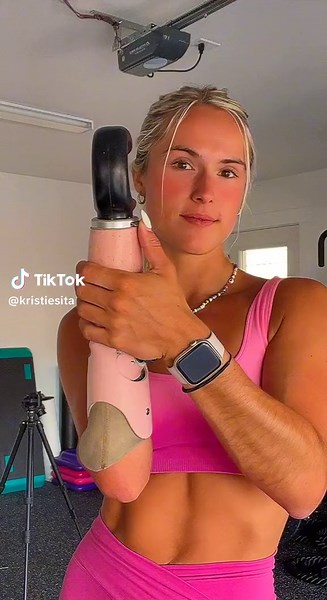 cut loose and take off an arm with me #amputee #amputation #prosthetic #fyp