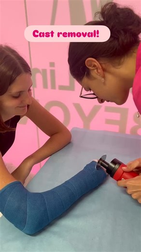 Removing the cast and making a thermoplastic splint!! Benefits of custom made thermoplastic splint: 🩷Light weight 🩷Can check the wounds 🩷Change the dressing 🩷Breathable 🩷Plus so much more comfort and lighter for the patient! #upperlimbsandbeyond #mackayhandtherapist #lymphoedematherapy #occupationaltherapy #tfccrepair Clinic Disclaimer: Case studies & images are for educational purposes. Individual results vary. Content is not medical advice. | Upper Limbs & Beyond