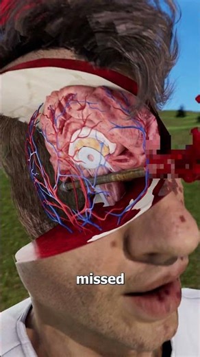 He Survived An Arrow Through His Skull 😵