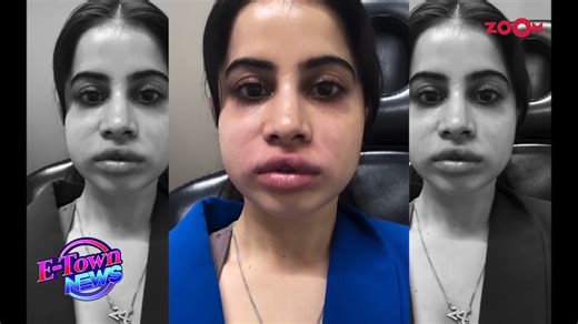 51K views · 76 reactions | Urfi Javed shocked fans by sharing a raw...