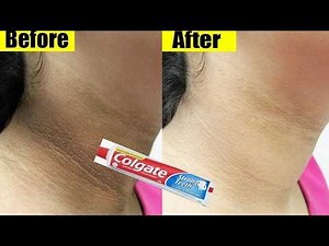 "I Tried the Viral TikTok Toothpaste & Vaseline Mask ✨ You Won’t Believe the Result!" ✅