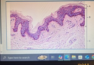 The image provided shows a histological slide of skin tissue wi... | Filo