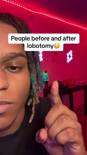 People Before and After Lobotomy - Shocking Transformation Revealed!