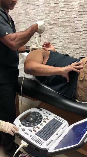 Calcific Barbotage - clinical vid