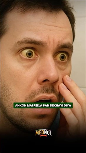 Symptoms of Jaundice You Should Never Ignore | 2025 | #jaundice #jaundicesymptoms