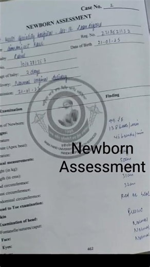 Newborn Assessment 🩺#newborn #newborncare #newbornphotography#shorts #shortsfeed #youtubeshorts